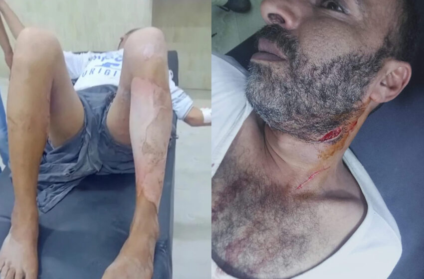  بسبب كرسي.. ذبح مواطن وإحراق زوج شقيقته في فاقوس